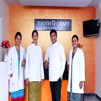 Dental Veneers Cost in Chennai